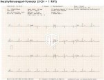 Cardio M-PLUS cu PACS Cardio M-PLUS cu PACS, ECG de repaus cu 12 canale și ecran tactil de 7