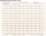 Cardio M-PLUS cu PACS Cardio M-PLUS cu PACS, ECG de repaus cu 12 canale și ecran tactil de 7