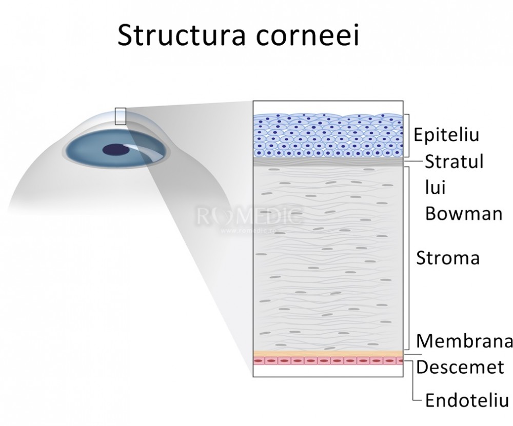 Anomalii Congenitale Ale Corneei