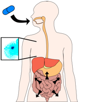 Diagnosticarea cancerului mamar cu ajutorul unei pilule