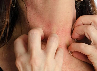 Cum abordăm corect alergiile pielii