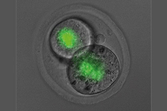 Moștenirea genetică este mai importantă decât se credea anterior, potrivit unui studiu