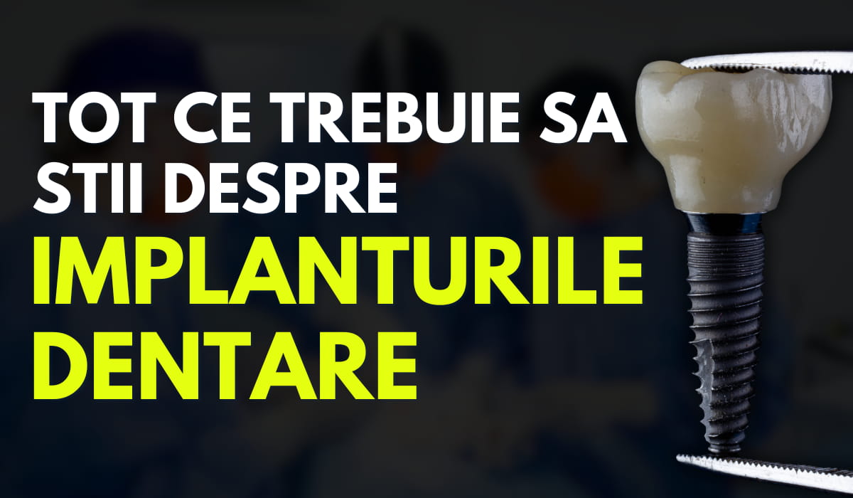 Tot Ce Trebuie Sa Stii Despre Implanturile Dentare